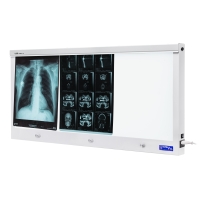 Negatoskopy slim LED NGP